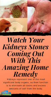 Pin On Health Tips