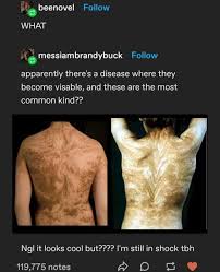 Humans Have Stripes' – Truth Or Fiction?