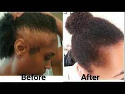 Down My Back My Hair Growth Natural Shampoo Scrub Scalp Etsy Rapid Hair Growth Hair Growth Challenge Grow Hair