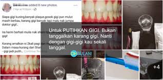 Rawatan ini bukan hanya boleh putihkan gigi sahaja, malah mampu merawat mereka yang mempunyai masalah gusi yang sensitif. Bodoh Betul Petua Tips Putihkan Gigi Cara Natural Doktor Selar Tindakan Individu Ini