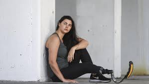 Amputee model Jess Quinn's journey to self-acceptance | Stuff