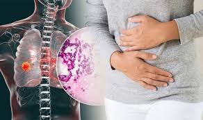 My stomach and lungs draw a pair of lungs and a stomach inside the body. Lung Cancer Symptoms A Belly Symptom May Be One Of The First Signs Of The Deadly Disease Sound Health And Lasting Wealth
