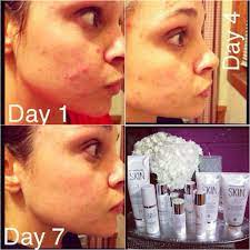 Love Herbalifeskin It S Amazing Garuntee Results In 7days Follow Me On Ig Keladynicole Skincare Herbalife Herbalife Nutrition Herbalife Results Skin