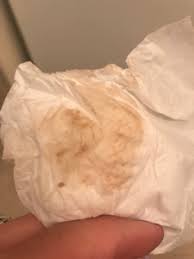 Brown discharge pictures of spotting during pregnancy. Tmi Picture Is This Normal February 2018 Babies Forums What To Expect