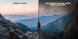 Some people with glaucoma have low vision. low vision means there may be problems doing daily, routine some of the difficulties associated with low vision include problems with glare, lighting, and. Glaucoma The Silent Thief Of Sight Health Wellness Spec Savers South Africa