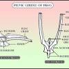 Severe cases may require packing with medication and padding the hoof. 1