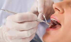 Enhance Family Dental Health in 2024: Expert Tips from Pine Grove Family Dental