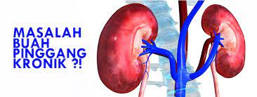 Penyakit penapis buah pinggang bocor @ nephrotic syndrome akan menyebabkan bengkak (edema), terutamanya pada kaki dan buku lali dan ia juga meningkatkan lagi risiko kepada penyakit lain seperti. Bila Ada 7 Tanda Ini Awas Buah Pinggang Sebenarnya Ada Masalah Remaja