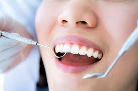 Certain foods such as crackers and breads can increase plaque. Will Teeth Cleaning Remove Stains Westerville Dental Associates
