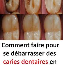 Une Coquille D œuf Contient Une Substance Ideale Pour La Guerison Des Cavites Que Le Dentifrice Ordin Baking Soda Under Eyes Natural Medicine Oral Health Care