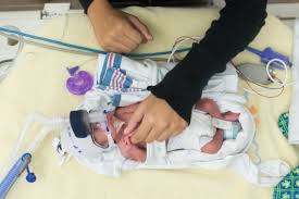 Image result for Preterm Infant