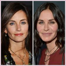 Celebrities Plastic Surgery Gone Wrong 10 Regrets Cosmetic Surgery Is A Dangerous Affair At The Very Least For Celebrities Who Find Yourself With Botched Celebrity Plastic Surgery Plastic