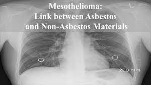 Asbestos has been used in insulation, in auto manufacturing, shingles, ceiling and floor tiles, and more. Mesothelioma Link Between Asbestos And Non Asbestos Materials Yo Nature