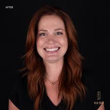 Blue Door Dental Design // Dr. Robin Bethell