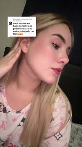 Un mes y una semana después de la bichectomía