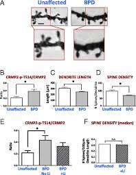 Listen to the audio pronunciation in several we're doing our best to make sure our content is useful, accurate and safe. Probing The Lithium Response Pathway In Hipscs Implicates The Phosphoregulatory Set Point For A Cytoskeletal Modulator In Bipolar Pathogenesis Pnas