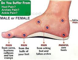 Pin On Varicose Vein Remedy