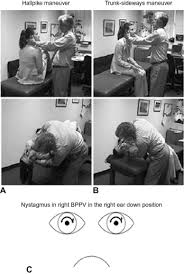 Image result for Horizontal Head Impulse Test