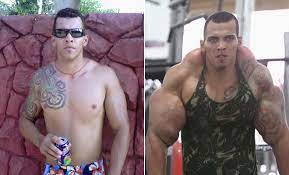 For years, experts considered body dysmorphia and disorders like. The Horrifying Story Of A Bodybuilder Who Was Addicted To Muscle Injections For The Win