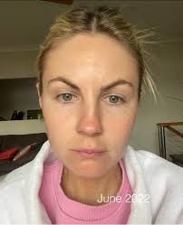 Is the Dr Dennis Gross LED mask worth the money?