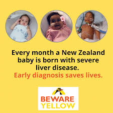 Cancers in children are sometimes hard to recognize because common illnesses or everyday bumps and bruises can mask the early warning signs. Learn The Signs Of Childhood Liver Idfnz Kids Foundation Facebook