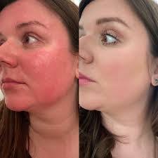 Kezia Baxter's Instagram, Twitter & Facebook