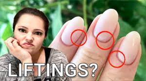 Mit dem gelnägel set lassen sich einfach eigene gelnägel modellieren. Gel Halt Einfach Nicht Nageltyp Analyse Feuchte Nagel Youtube