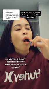 Filipina Queen Shares Secrets to White Teeth