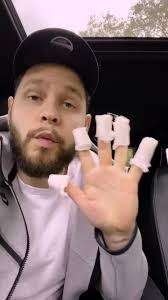 Burned my fingerprints off