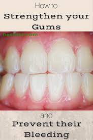 Quinones, past president of you can wear down your enamel if you brush too fast and hard. How To Strengthen Your Gums And Prevent Their Bleeding Herbiol Gum Health Receding Gums Grow Back Receding Gums
