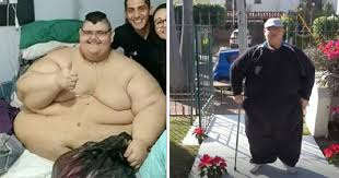 Un mexicain considéré comme l'homme le plus gros du monde lorsqu'il pesait 600 kilos a été admis vendredi dans un hôpital de guadalajara (ouest) pour subir un pontage gastrique mardi, a annoncé son médecin. L Homme Le Plus Gros Du Monde Change De Vie En Perdant 330kg Il Peut Maintenant Marcher Pour La Premiere Fois En Presque 10 Ans