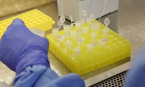 Uma vacina contra o coronavírus desenvolvida pela universidade de oxford, no reino unido, mostra sinais de ser segura e de treinar o sistema ainda é cedo para perceber, por completo, que esta vacina funciona, já que continuam a ser feitos testes com uma amostra mais alargada. Incendio Atinge Fabrica Da Vacina De Oxford Na India
