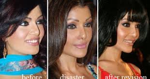 Pin By Sanchit Choudhary On Things For My Wall Celebrity Plastic Surgery Bad Plastic Surgeries Nose Plastic Surgery