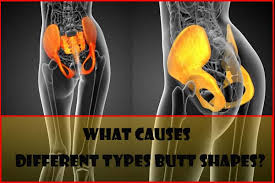 As you can see, men have greater glute size than women. Different Types Of Buttocks On Females Which Butt Shapes Do You Have