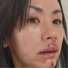 「医師からもう長くないと」犬に噛まれて30針を縫うケガだけでは ...