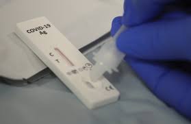 În capitală au apărut în vânzare teste pentru depistarea noului coronavirus. Autotestes Para Que Servem E Como Podem Ser Feitos Em Casa Perguntas E Respostas Publico