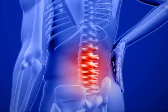 Sciatica causes