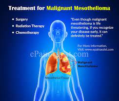 The most important thing you can do to prevent mesothelioma is to use appropriate precautions if you are exposed to asbestos at work. Treatment For Malignant Mesothelioma Surgery Radiation Chemotherapy Clinical Trial Coping Home Remedies Prevention