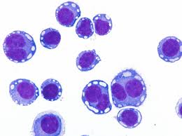 Animal cell vs human cell. German Collection Of Microorganisms And Cell Cultures Gmbh Human And Animal Cell Lines