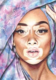 Skin of colour dermatology