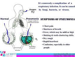 Pneumonia Is A Lung Infection That Can Make You Very Sick It S Commonly A Complication Of A Respirator Lung Infection Respiratory Infection Pneumonia Symptoms
