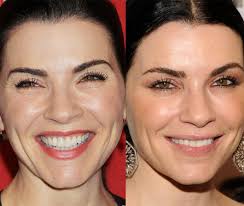 Résultat de recherche d'images pour "julianna margulies"