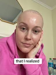 Lauren Oconnell Survivor Before and Agter