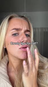 Crusty lips? No 🙅🏽‍♀️ Our Juicy AF Lip Oils are here to save the day! Get  up to 25% off all lip products until Sunday! #dashlbeauty #lipoil  #lipplumper #lipcombo #fyp