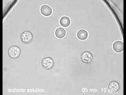 If placed in a hypotonic solution, water molecules will enter the cell, causing it to swell and burst. Osmotic Burst Of Blood Cells Youtube