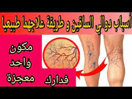 علاج دوالى ااساقين دكتور مازن السقا. Ø¹Ù„Ø§Ø¬ Ø¯ÙˆØ§Ù„Ù‰ Ø§Ø§Ø³Ø§Ù‚ÙŠÙ† Ø¯ÙƒØªÙˆØ± Ù…Ø§Ø²Ù† Ø§Ù„Ø³Ù‚Ø§ ÙƒÙ†Ø² Ø¬Ø¹Ù„Ù‡ Ø§Ù„Ù„Ù‡ Ø¹Ù„Ø§Ø¬ Ø¯ÙˆØ§Ù„ÙŠ Ø§Ù„Ø³Ø§Ù‚ÙŠÙ† ÙˆÙŠØ´ÙÙŠ Ø¨Ø³Ø±Ø¹Ø© Ø·Ø±Ù‚ Ø·Ø¨ÙŠØ¹ÙŠØ© Yafik Rian