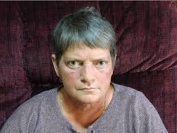 Proposed diluted chemo settlement 'like a slap in the face'