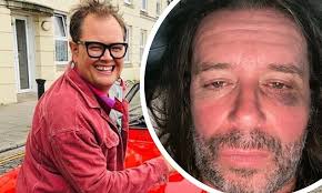 Alan Carr breaks his social media silence after sparking concern