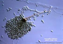 Aspergillus is a filamentous, cosmopolitan and ubiquitous fungus found in nature. Aspergillus Species Doctor Fungus