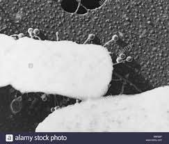 Bacteriofago lambda 1 record at right shows a virus that attacks bacteria, known as the lambda bacteriophage, which measures roughly nanometers. Sobre E Coli Fago Lambda Fotografia De Stock Alamy